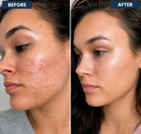 Soothewell™ | Targeted Skin Care Rollerball Pen