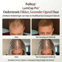 Follica™ LumiCap Pro